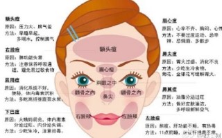 下巴长痘痘什么原因,肝火旺哪里长痘痘
