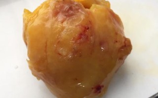 鸡球在哪里（鸡腹部有肉球是什么东西）