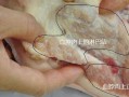 猪肉哪里不能吃（猪肉哪里不可以吃）