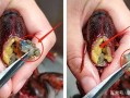 小龙虾的什么部位不能吃,龙虾头什么地方不能吃