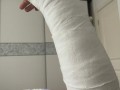 哪里可以做刺骨（哪里可以做刺骨手术）