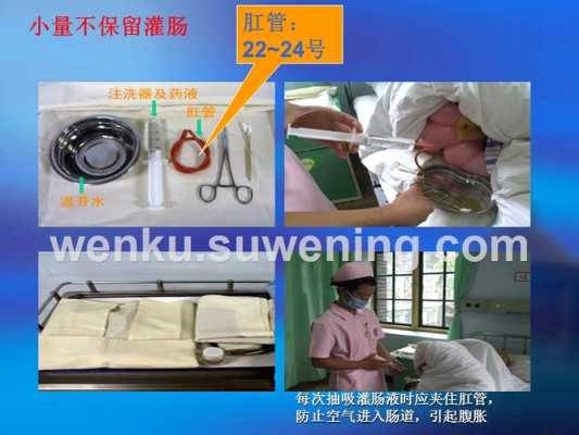 哪里可以灌肠（医院哪里可以灌肠）-第1张图片-厨房小当家
