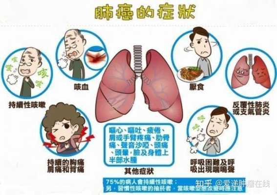 肺癌容易转移哪里,哪里适合养肺病人-第2张图片-厨房小当家 肺癌容易转移哪里,哪里适合养肺病人-第2张图片-厨房小当家