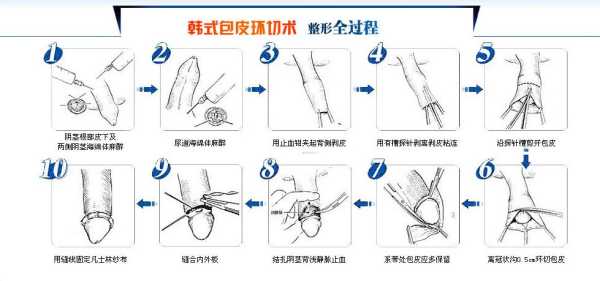 成都哪里可以包皮蛋(成都包皮哪里做的好)-第2张图片-厨房小当家 成都哪里可以包皮蛋(成都包皮哪里做的好)-第2张图片-厨房小当家