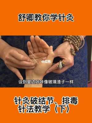 针灸哪里可以排毒(针灸哪里可以排毒)-第2张图片-厨房小当家 针灸哪里可以排毒(针灸哪里可以排毒)-第2张图片-厨房小当家