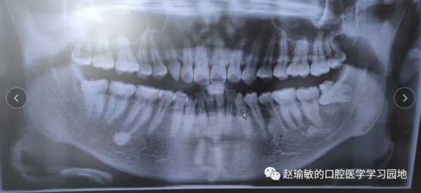 骨头山在哪里(骨岛什么意思)-第3张图片-厨房小当家 骨头山在哪里(骨岛什么意思)-第3张图片-厨房小当家